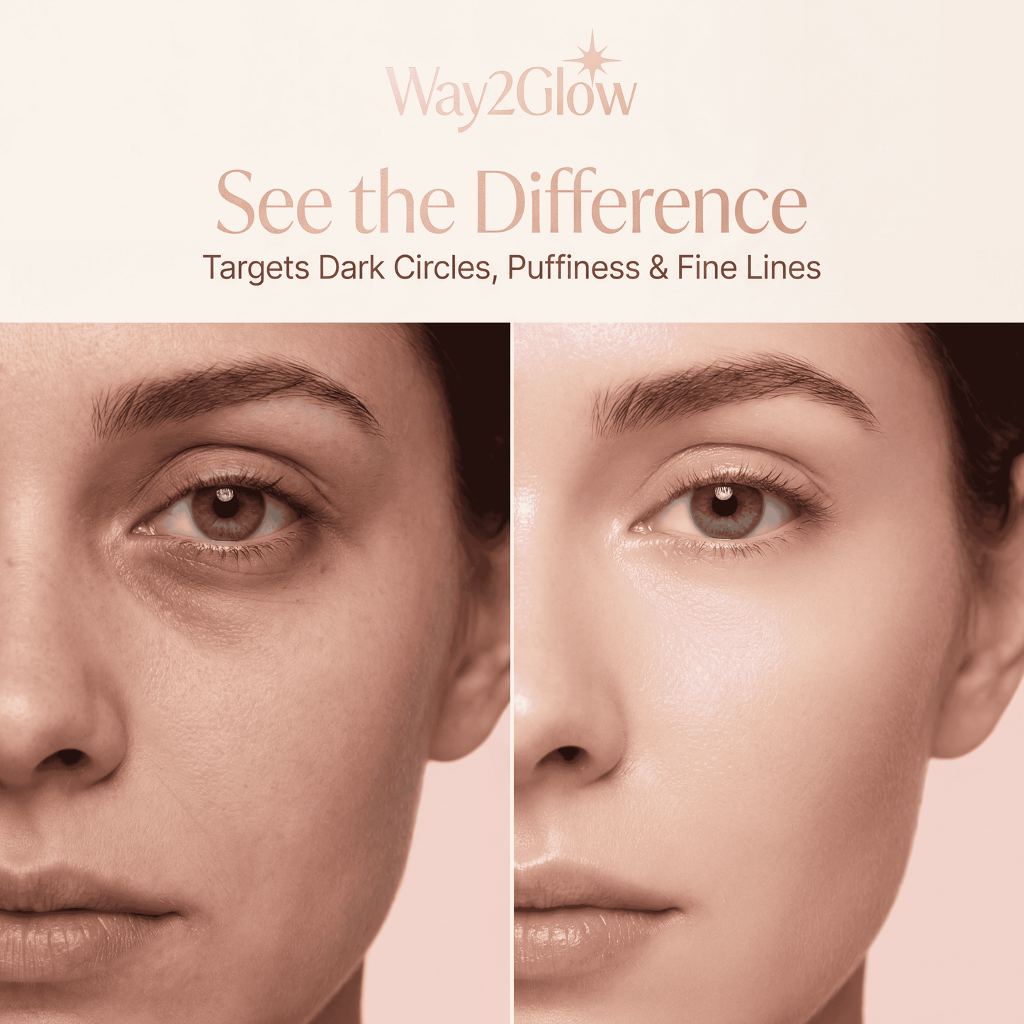 Red Light Therapy Eye Device for Dark Circles, Puffiness & Fine Lines | Way2Glow